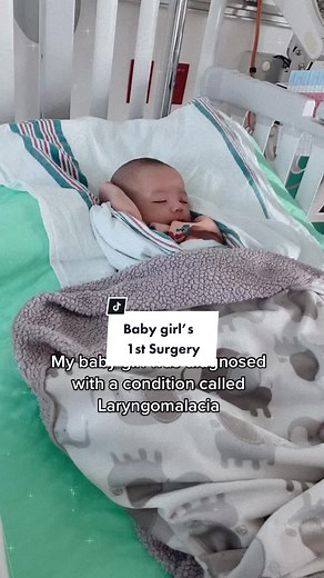 Understanding Laryngomalacia Surgery in Babies - A Parent's Guide