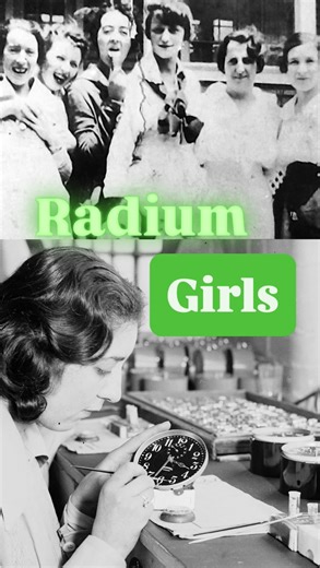 The Bone Museum on Instagram: "💀✨ The Radium Glow ✨💀🕰️ In the early 1900s, women known as the Radium Girls painted watch dials with glowing radium paint—often licking their brushes to keep a fine point. They had no idea the “miracle element” was silently destroying them from the inside. Once in the body, radium behaves like calcium, embedding itself in the bones. Over time, it irradiates the skeleton from within, causing bone death, fractures, anemia, and even cancers. Many developed a haunti