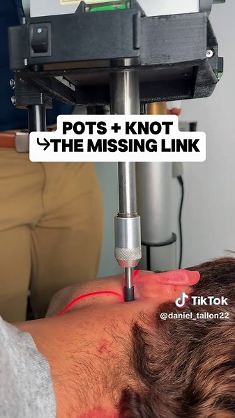 Many people with POTS tell me the same thing… They’ve had a constant knot or pressure at the base of the skull for years. If you’re experiencing: • dizziness • heart palpitations • brain fog • gut dysfunction …but every test keeps coming back “normal”… The missing link may be in the upper neck. A structural misalignment here can place stress on the brainstem and vagus nerve, disrupting the autonomic nervous system. That’s why our approach is different. No twisting. No cracking. No popping. Just 