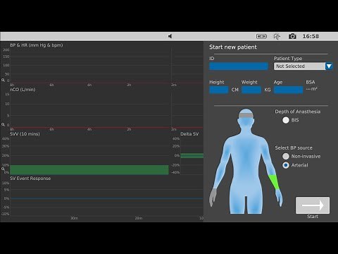 How to setup minimally invasive hemodynamic monitoring | LiDCO (US)