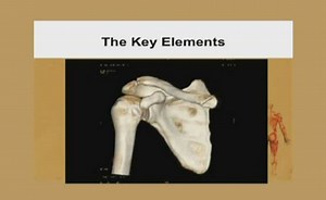 AC Joint Mechanics and Management Techniques