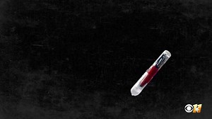 101K views · 273 reactions | Microchips are being implanted in people! A look at this incredible technology and how it works, only on CBS11 tonight at 10pm. | CBS News Texas | Facebook