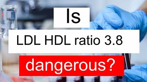 Is LDL HDL ratio 3.8 high, normal or dangerous? What does LDL HDL ratio level 3.8 mean?