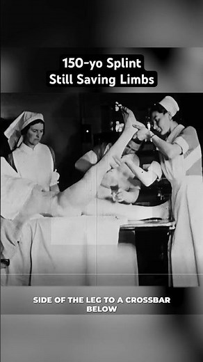From 80% Mortality to 16% — The Splint That Changed Broken Leg Care