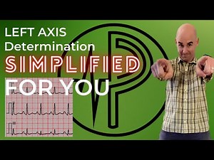Left Axis Deviation Simplified for YOU!!!