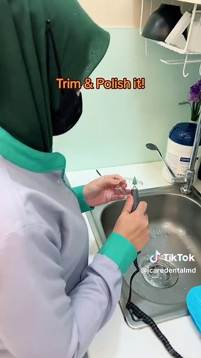 How to Trim and Polish Your ESSIX Retainer for a Perfect Fit!