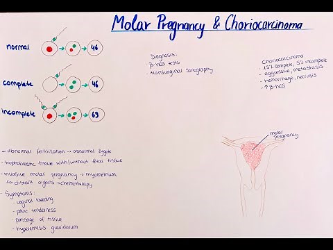 Molar Pregnancy, Choriocarcinoma, Chorionepithelioma