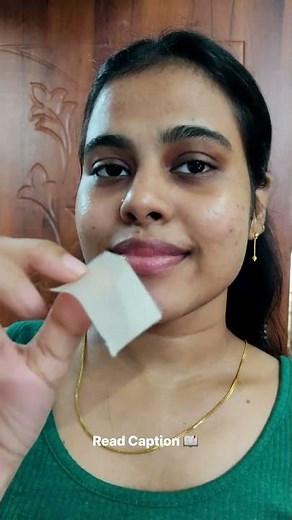 Using silicone scar tape to fade my acne scars #acnescars #acnescarremoval #siliconetape
