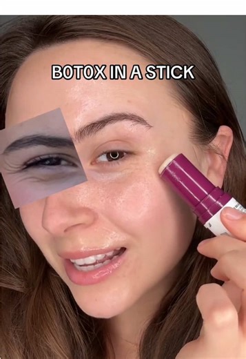 Uh hello 2 days of progress & look at those forehead lines…..