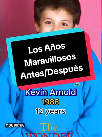 Los Años Maravillosos Antes/Después #thewonderyears #losañosmaravillosos #antesdespues #viral #doctor80s