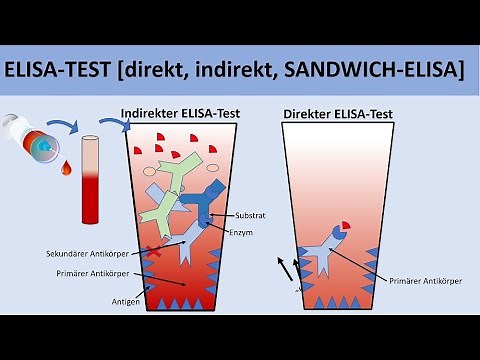 ELISA Test [direct, indirect, SANDWICH-ELISA] - [Biology, Immunobiology]