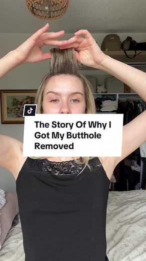 This is the sparknotes version obviously because the whole storytime would be hours long 😃 #ostomy #ibd #awareness #storytime #mystory #medicalmystery #thingsyoushouldknow