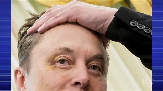 Elon Musk aparece com olho roxo na Casa Branca