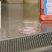 Video: Incorporating Pericytes into an Endothelial Cell Bead Sprouting Assay