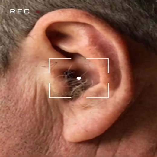 DID YOU KNOW that if hair grows on your ears, it’s because your body is…Read more in Comment or Most relevant -> All comments 👇 | Awesome Wondrous 881