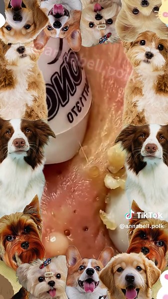 Pimple Cyst and Blackhead Removal Techniques