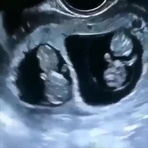 1M views · 110K reactions | Twins babies - Hey doll, you are looking beautiful ❤ | 홲횑횞횋횋횢 | Facebook