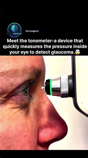 How Doctors Test Eye Pressure for Glaucoma! 👁️✨ #MedicalTech