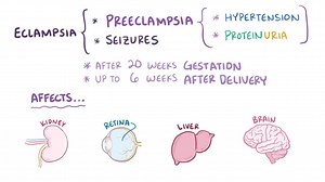 Video: Preeclampsia & eclampsia - Video Explanation! | Osmosis | Osmosis