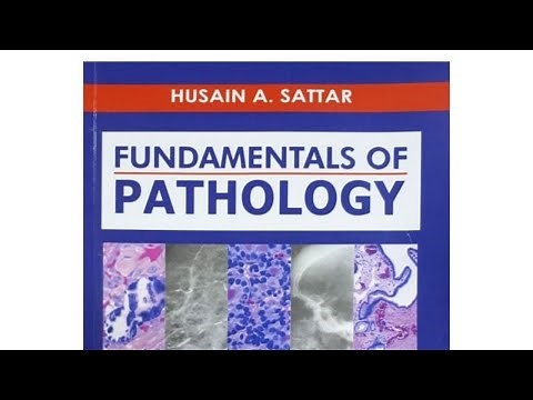 Pathoma Ch 3 Neoplasia ▶️ Benign vs Malignant, Cancer Hallmarks, Metastasis | Step 1 2024 (HY!)