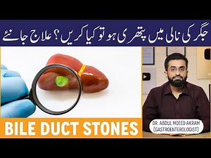 Jigar Ki Nali Me Pathri Ki Alamat Aur Ilaj - Bile Duct Stones Symptoms & Treatment - ERCP Procedure