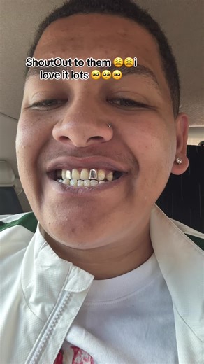 Custom Grillz: Thank You for Your Support!