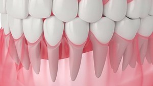 Human Jaw Cracking Tooth Process Stock Footage Video (100% Royalty-free) 1076931974 | Shutterstock