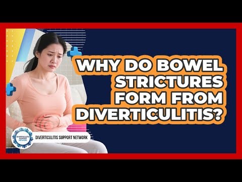 Why Do Bowel Strictures Form From Diverticulitis?