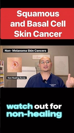 Warning Signs of Non-Melanoma Skin Cancer: What to Watch For