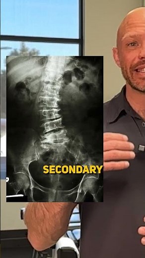 Discover how leg length discrepancy impacts back pain and learn effective methods.👍