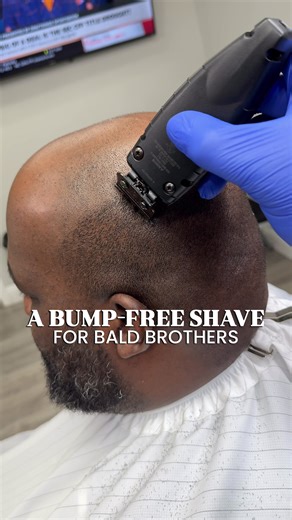 Achieve a Smooth Scalp: Cleanse, Calm, Protect Method