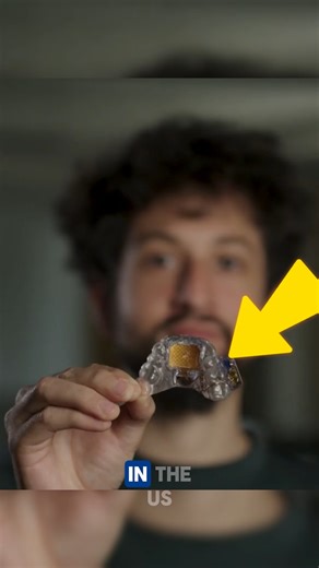 7K views · 80 reactions | How Touch-to-Control Works How Touch-to-Control Works – A breakthrough in assistive technology is changing lives! This innovative oral device turns simple head and tongue gestures into seamless phone control, empowering independence for those with physical limitations.  Credits:@augmentaltech /YT #AssistiveTech #Innovation #LifeChangingTech #touch #mouth | OnyN News | Facebook