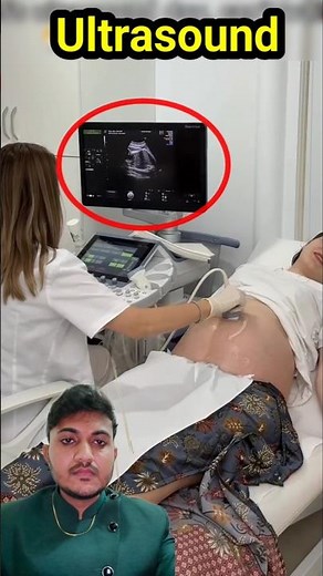 Pregnancy Ultrasound #ultrasound #sonography #pregnancy