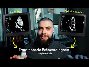How to Perform a Transthoracic Echocardiogram (TTE) | Step-by-Step Guide!