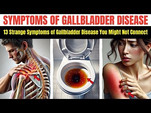 13 Strange Symptoms of Gallbladder Disease You Might Not Connect | symptoms of gallbladder problems