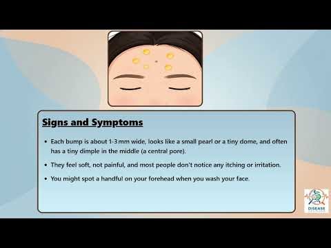 Sebaceous Hyperplasia Explained Causes, Symptoms and Treatment, All Insights