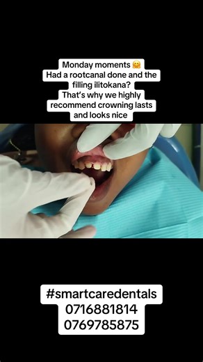 Crowning After Root Canal: What You Need to Know