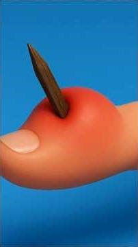 How Splinters Get Unstuck | #Shorts