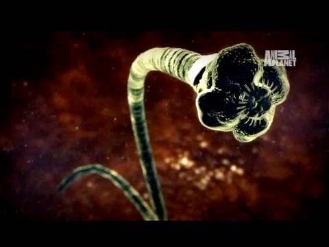 Monsters Inside Me: Tapeworm Invades Brain