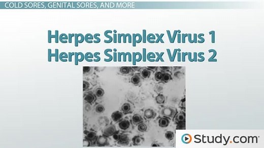 Chickenpox, Herpes, and Mono: Diseases of the Herpesviridae Virus Family