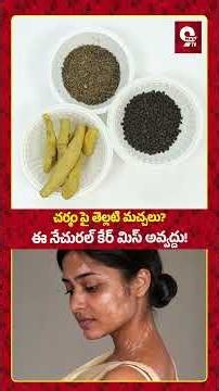 చర్మంపై తెల్లటి మచ్చలు తగ్గాలంటే ఈ Natural Skin Care మిస్ అవ్వద్దు | White Spots Treatment Tips