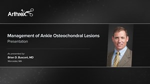 Management of Ankle Osteochondral Lesions