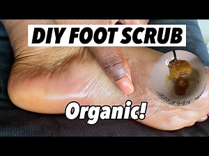 HOW TO MAKE A FOOT SCRUB (REMOVES DEADSKIN )