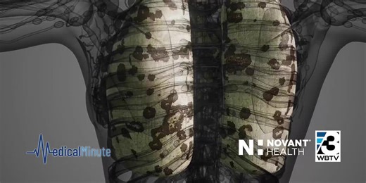 Identifying lung cancer early can lead to better outcomes