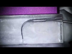 New ultrasonic tips from Woodpecker called "296GT" to manage calcified and severely curved canals