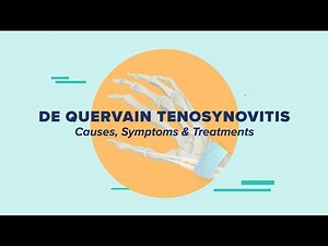 De Quervain Tenosynovitis