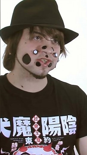 මෙයාගේ මූණ බලන්නකෝ 😱 වැඩිම සිදුරු ගිනස් වාර්තාව 😨 BioApi | #shorts #sinhala #science - Guinness