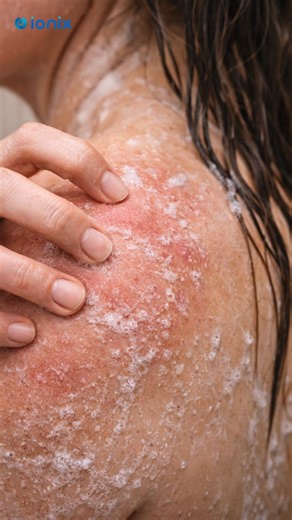 ionix_filters on Instagram: "📦 Product Introduction Experience the convenience of pure water 💧 with the Ionix 3 Stage Clear Pro Automatic Water Filter. This video features a real customer from Punjab 🇮🇳 sharing their genuine experience after installing Ionix Clear Pro. Designed with an automatic backwashing system 🔄 and a true “fit and forget” model ⚙️, this filter requires minimal maintenance—just plug it in 🔌 and enjoy clean water for years. Built specially for Indian water conditions 🏡