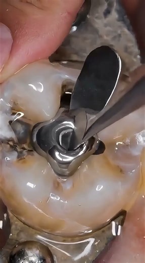 Satisfying Dental Amalgam Restoration Simulation 🦷 | High-Shine Metallic Finish #oddlysatisfying