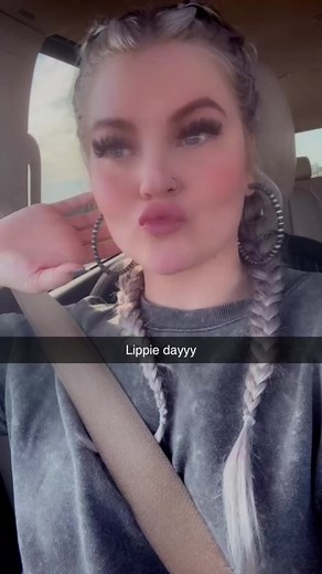 Lip injection time line 🤪 #lip #lipfiller #lipfillercheck #lipgloss #fyp #fypシ #fypシ゚viral